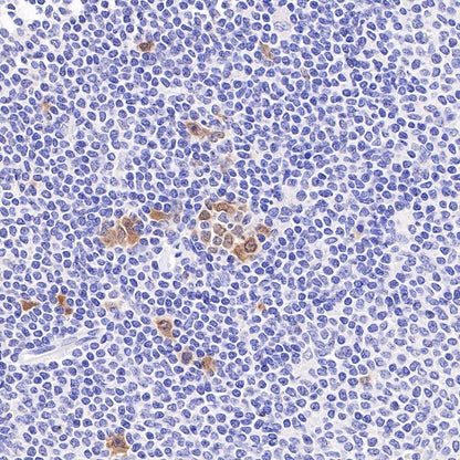 Thymidylate Synthase Recombinant Rabbit mAb (S-753-7)