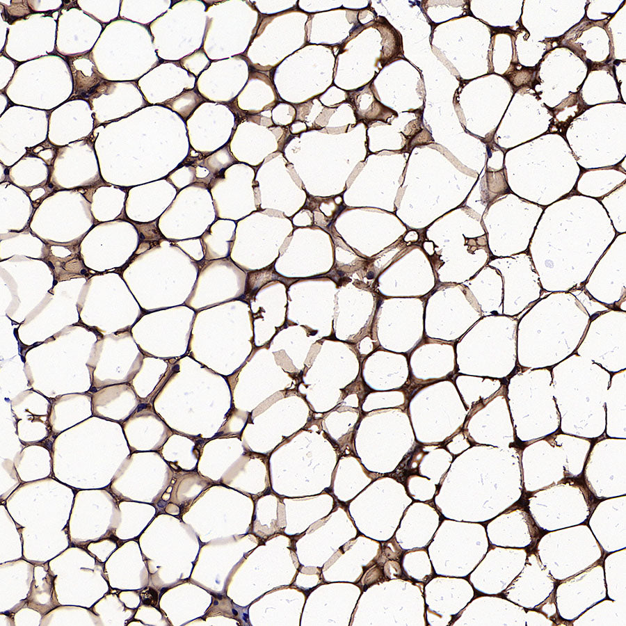 PNPLA2 Recombinant Rabbit mAb (S-5409)