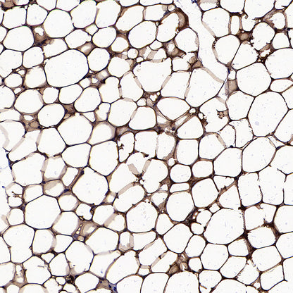 PNPLA2 Recombinant Rabbit mAb (S-5409)