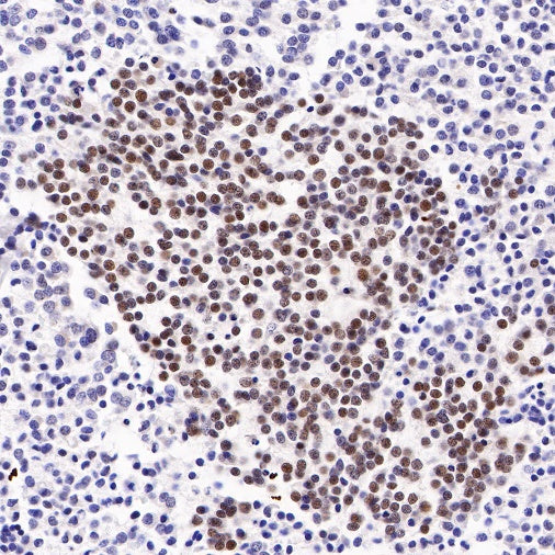 S-RMab® ATRX Recombinant Rabbit mAb (SDT-458-37)