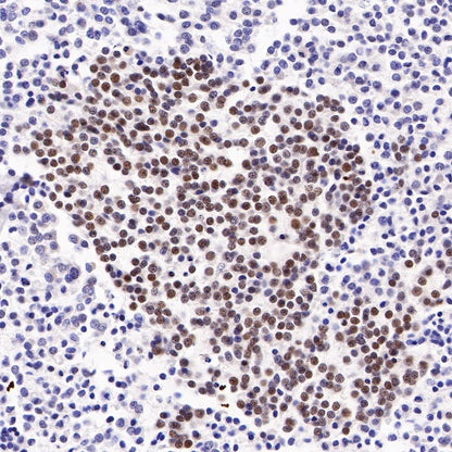 S-RMab® ATRX Recombinant Rabbit mAb (SDT-458-37)