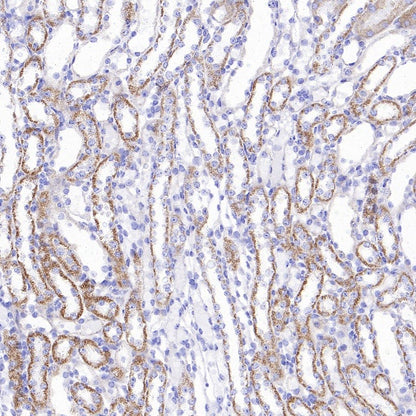 UQCRC2 Recombinant Rabbit mAb (S-1890-227)