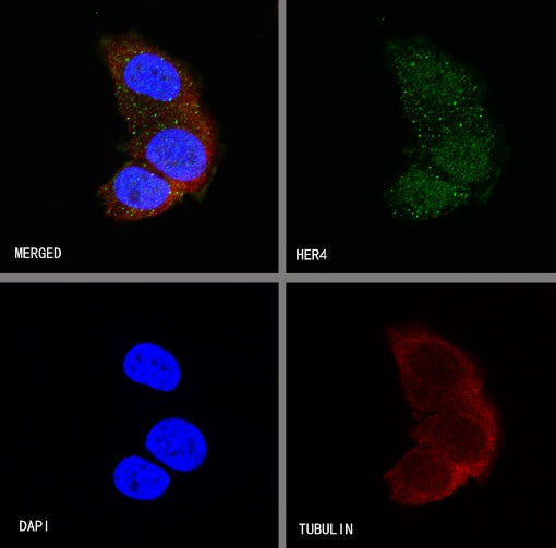 ErbB4 Recombinant Rabbit mAb (S-496-61)