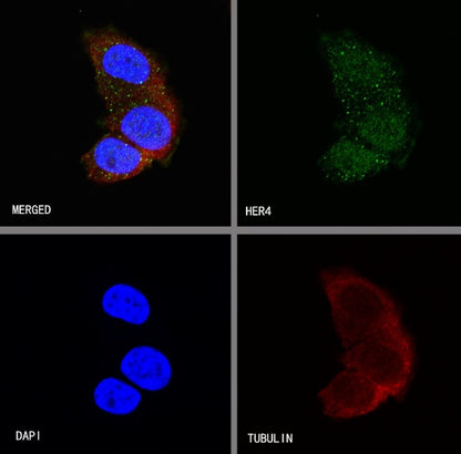 ErbB4 Recombinant Rabbit mAb (S-496-61)