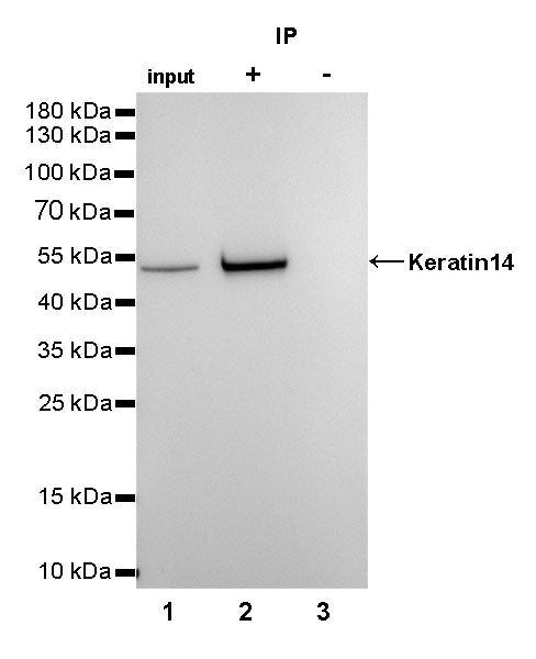 Keratin 14 Recombinant Rabbit mAb(SDT-023-1)