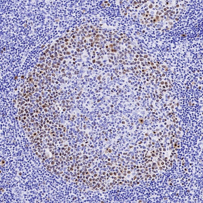 TOP2A Recombinant Rabbit mAb (S-513-107)