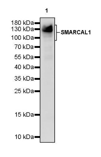 SMARCAL1 Recombinant Rabbit mAb (S-2110-328)