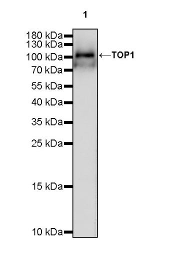 Topoisomerase I/TOP1 Recombinant Rabbit mAb (S-822-60)