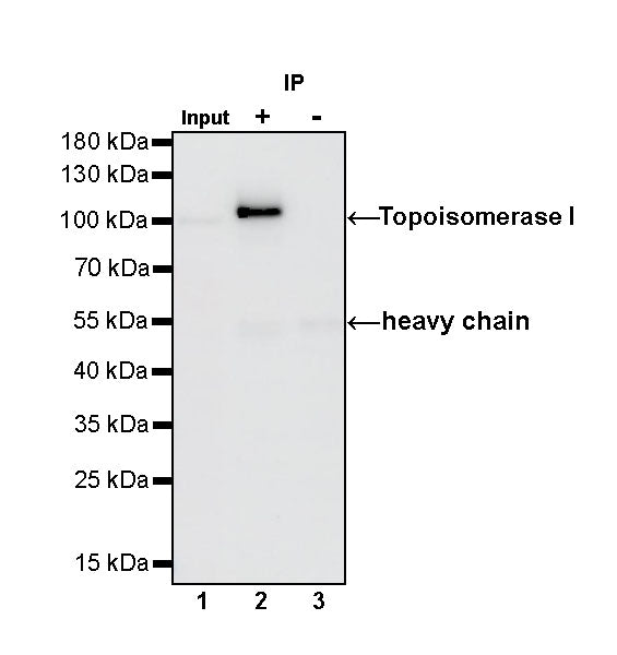 S-RMab®Topoisomerase I Recombinant Rabbit mAb (S-R209)