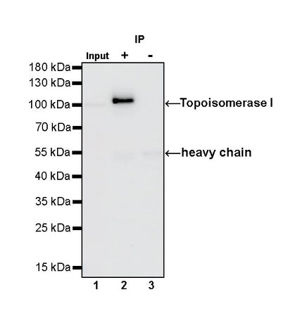 S-RMab®Topoisomerase I Recombinant Rabbit mAb (S-R209)