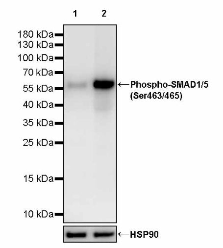 Phospho-SMAD1/5 (Ser463/465) Recombinant Rabbit mAb (S-4058)