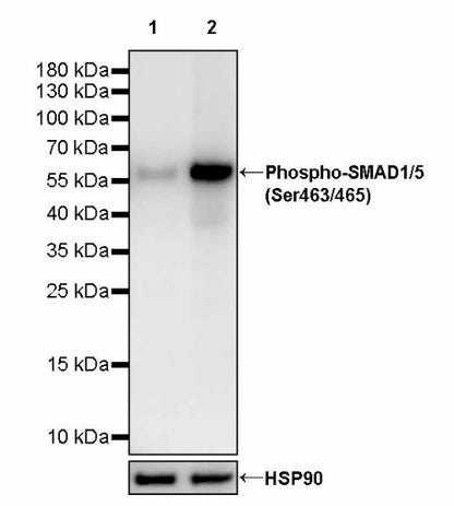 Phospho-SMAD1/5 (Ser463/465) Recombinant Rabbit mAb (S-4058)