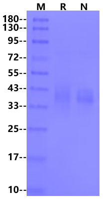 DLK1/FA1 His Tag Protein, Human