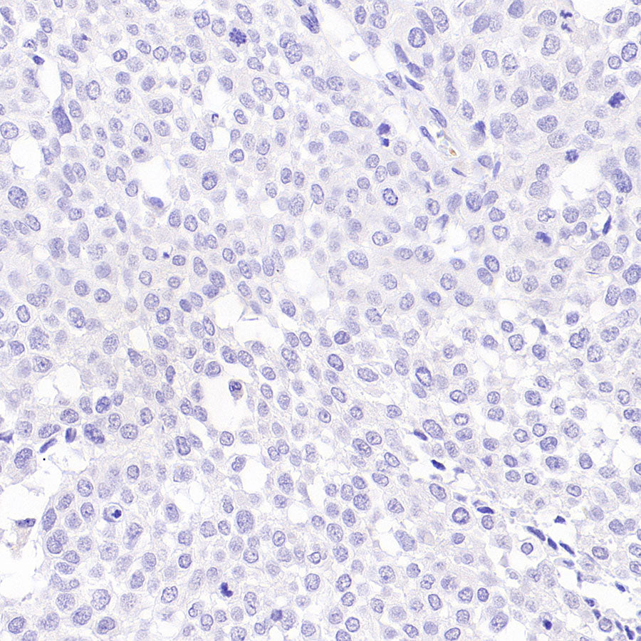 Napsin A Recombinant Mouse mAb (SDT-4204)