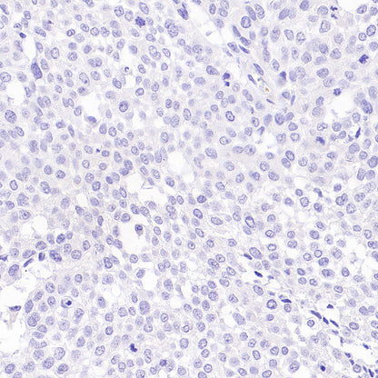 Napsin A Recombinant Mouse mAb (SDT-4204)
