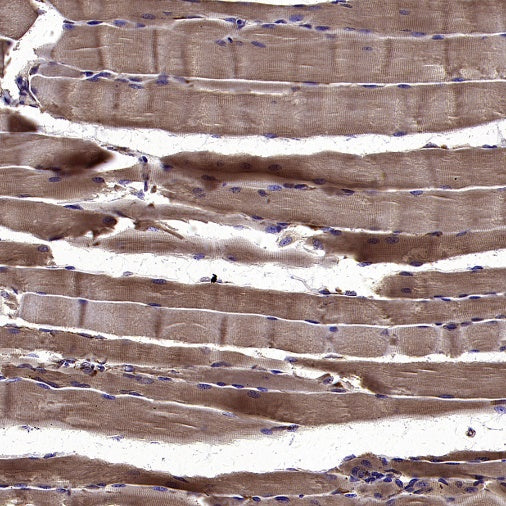AGTR1 Recombinant Rabbit mAb (S-2447-22)