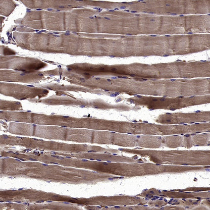AGTR1 Recombinant Rabbit mAb (S-2447-22)