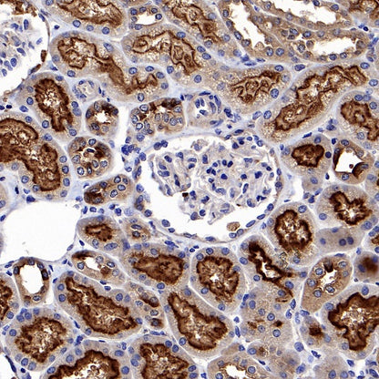 eIF3B Rabbit polyclonal antibody