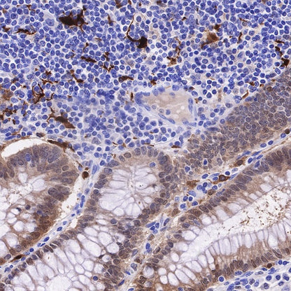 IL-18 Recombinant Rabbit mAb (S-2142-2)