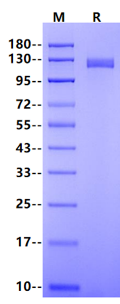 NCAM-1/CD56 Fc Chimera Protein, Human