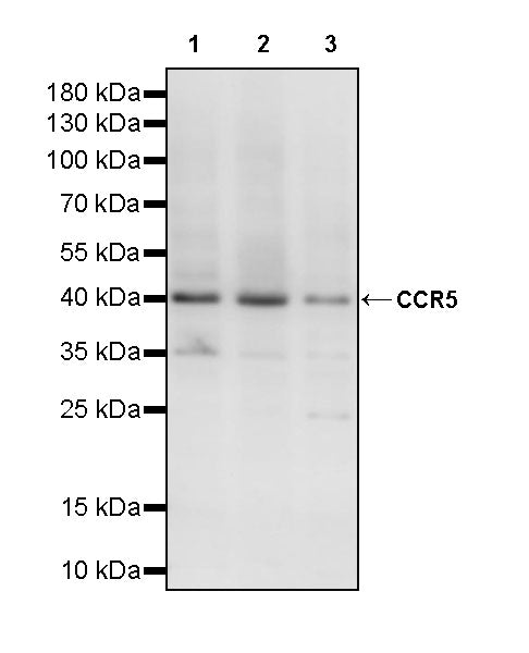 CCR5 Recombinant Rabbit mAb (S-2467-54)