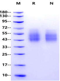 B7-2/CD86 His Tag Protein, Human
