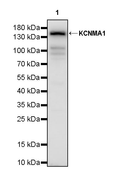 KCNMA1 Recombinant Rabbit mAb (S-2926-33)