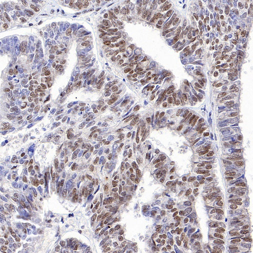 KDM6A Recombinant Rabbit mAb (S-1728-51)