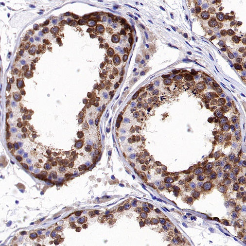 gamma Tubulin Recombinant Rabbit mAb (S-2204-13)