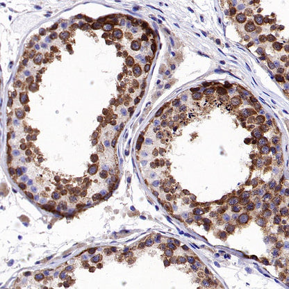 gamma Tubulin Recombinant Rabbit mAb (S-2204-13)