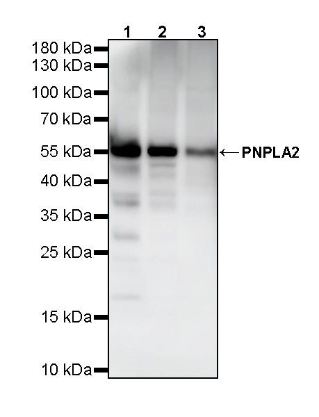 PNPLA2 Recombinant Rabbit mAb (S-5409)