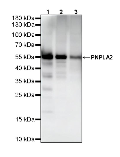 PNPLA2 Recombinant Rabbit mAb (S-5409)