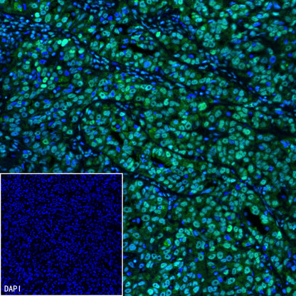 FUBP1 Recombinant Rabbit mAb (SDT-R060)