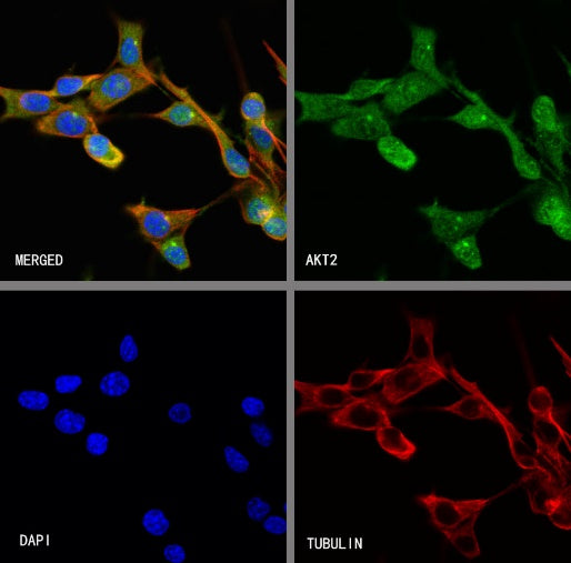 AKT2 Recombinant Rabbit mAb (S-2617-6)