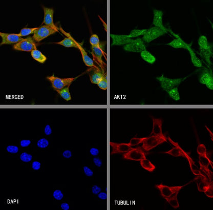 AKT2 Recombinant Rabbit mAb (S-2617-6)