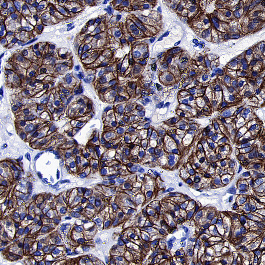 TSH Receptor/TSH-R Recombinant Rabbit mAb (S-5699)