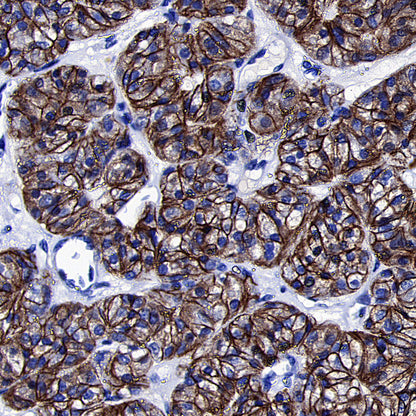 TSH Receptor/TSH-R Recombinant Rabbit mAb (S-5699)