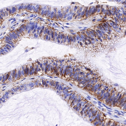 CD44 Recombinant Rabbit mAb (SDT-R107)