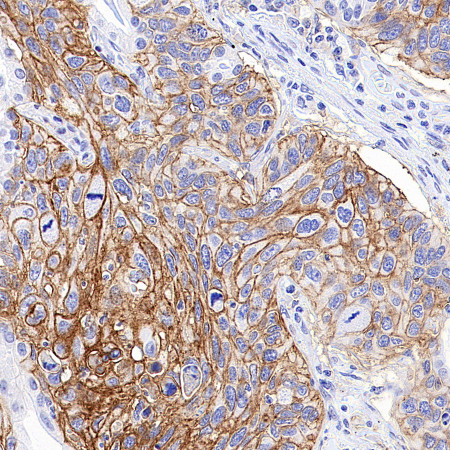 MCT1/Monocarboxylic acid transporter 1 Recombinant Rabbit mAb (S-5144)