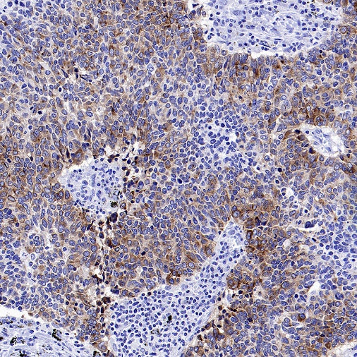 SEZ6 Recombinant Rabbit mAb (SDT-2097-7)