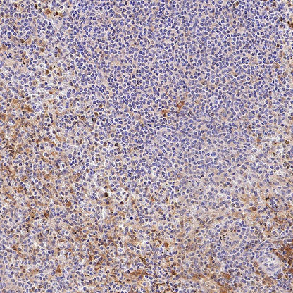 GBP5 Rabbit Polyclonal Antibody