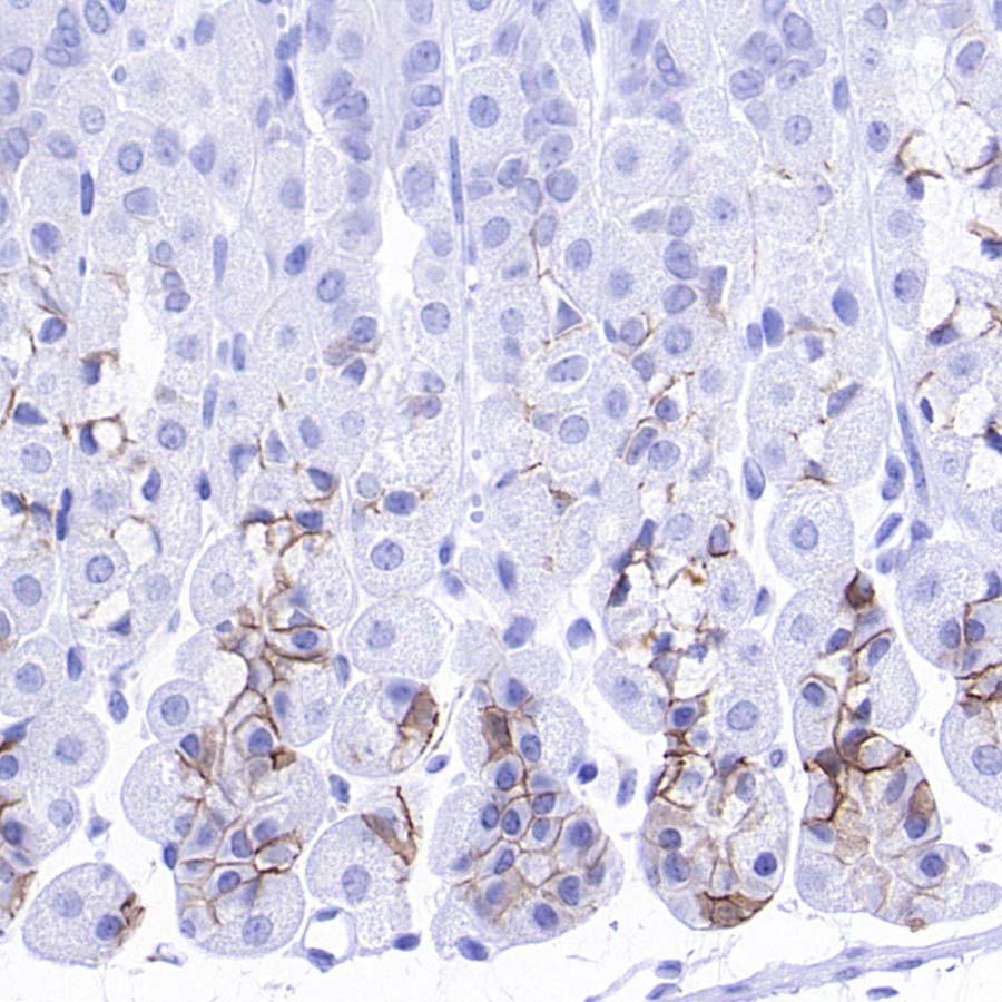 ALCAM Recombinant Rabbit mAb (S-4080-21)