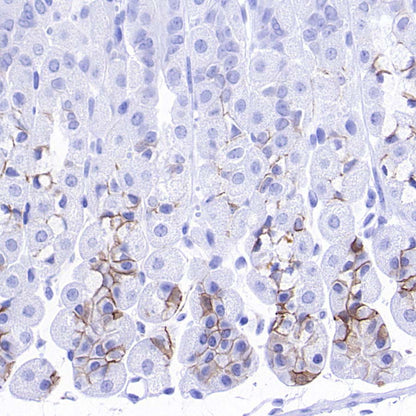 ALCAM Recombinant Rabbit mAb (S-4080-21)
