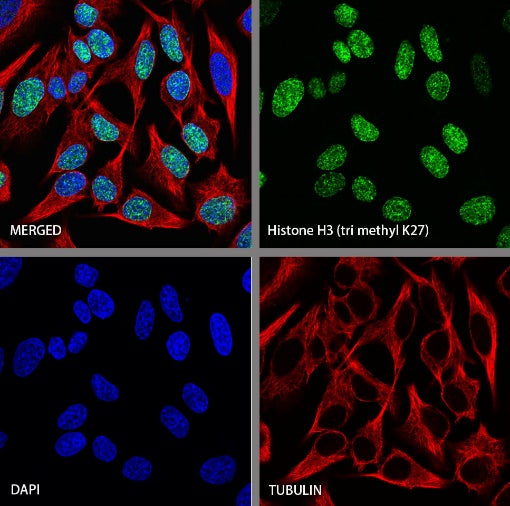 Histone H3 (tri methyl K27) Recombinant Rabbit mAb (S-4098)
