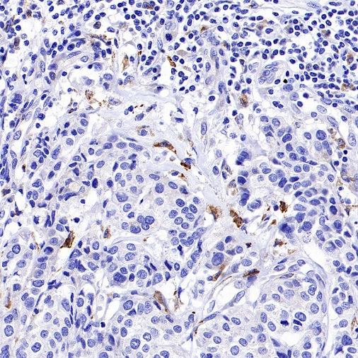 Progranulin Recombinant Rabbit mAb (S-2202-59)
