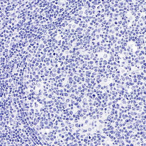 Mouse mAb IgG1, κ Isotype Control (S-844-79)