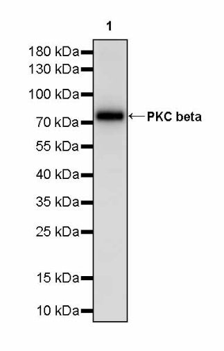 PKC beta Recombinant Rabbit mAb (S-3158-28)