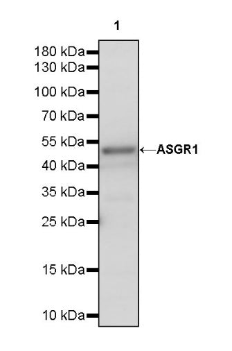 ASGR1 Rabbit Polyclonal Antibody
