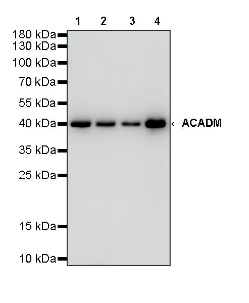 ACADM Mouse mAb