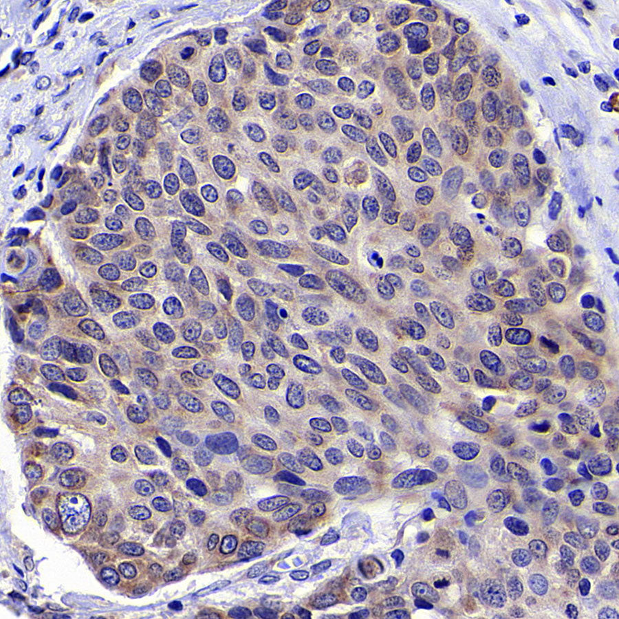 CCDC47 Recombinant Rabbit mAb (S-4158-17)
